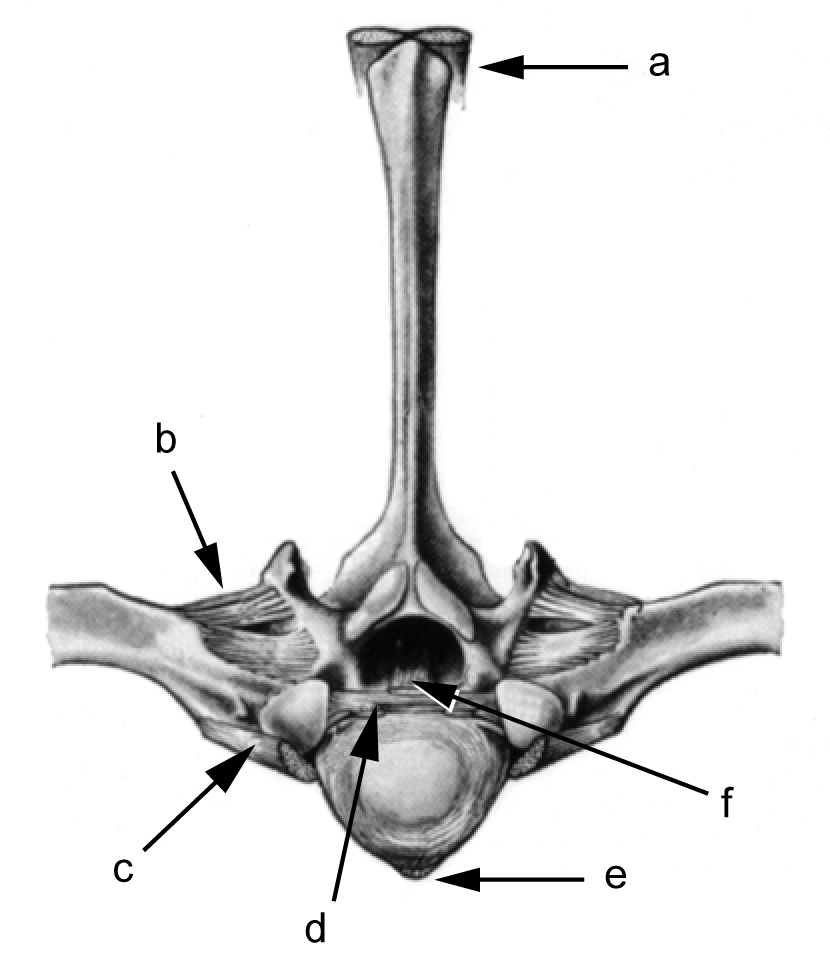 <p>Very tall dorsal spinous process, small transverse and articular spinous process</p>