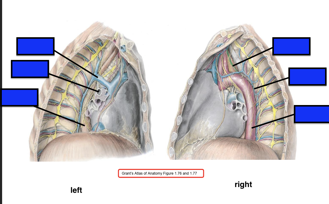 <p>switch left and right</p>