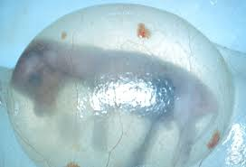 <p>What is the fluid surrounding the fetus?</p>