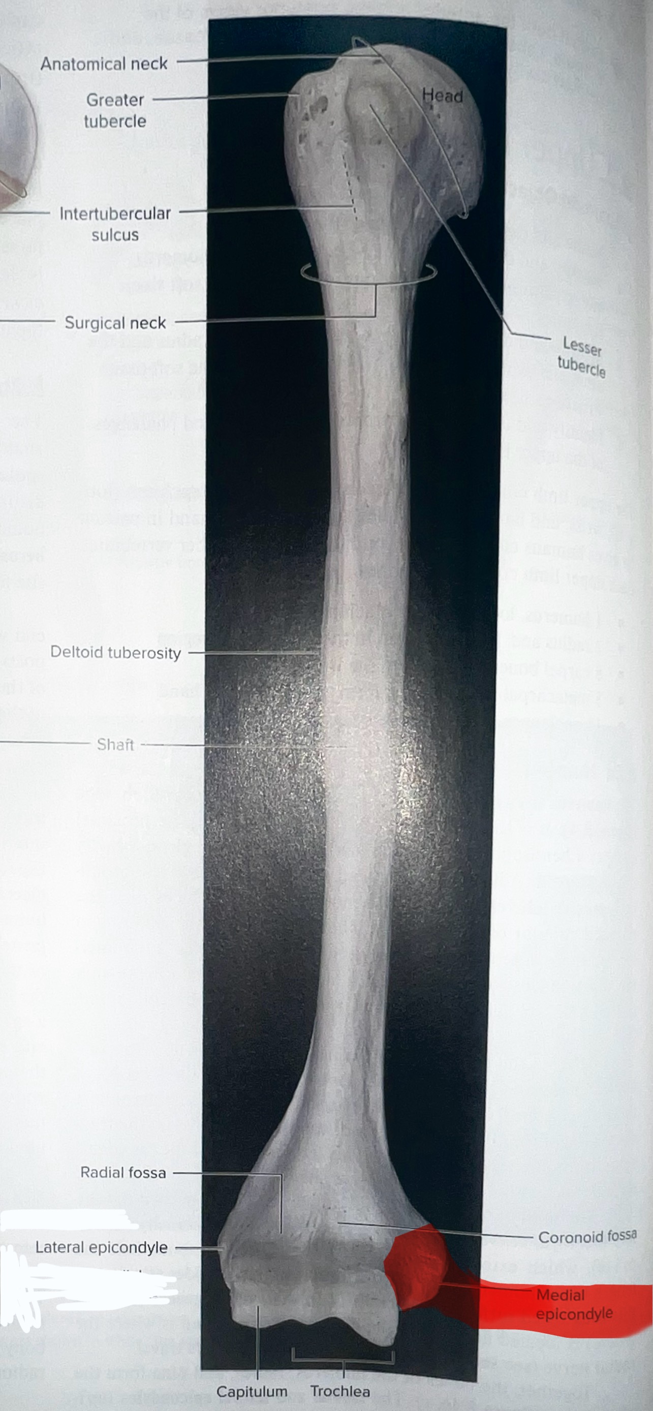 <p>attachment site for muscles</p>