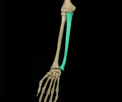 <p><span>giant U on proximal end </span></p>