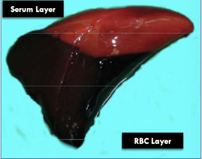 <p>blood (RBC) settle at the bottom → buffy coat of leukocytes → clotted serum at top</p>