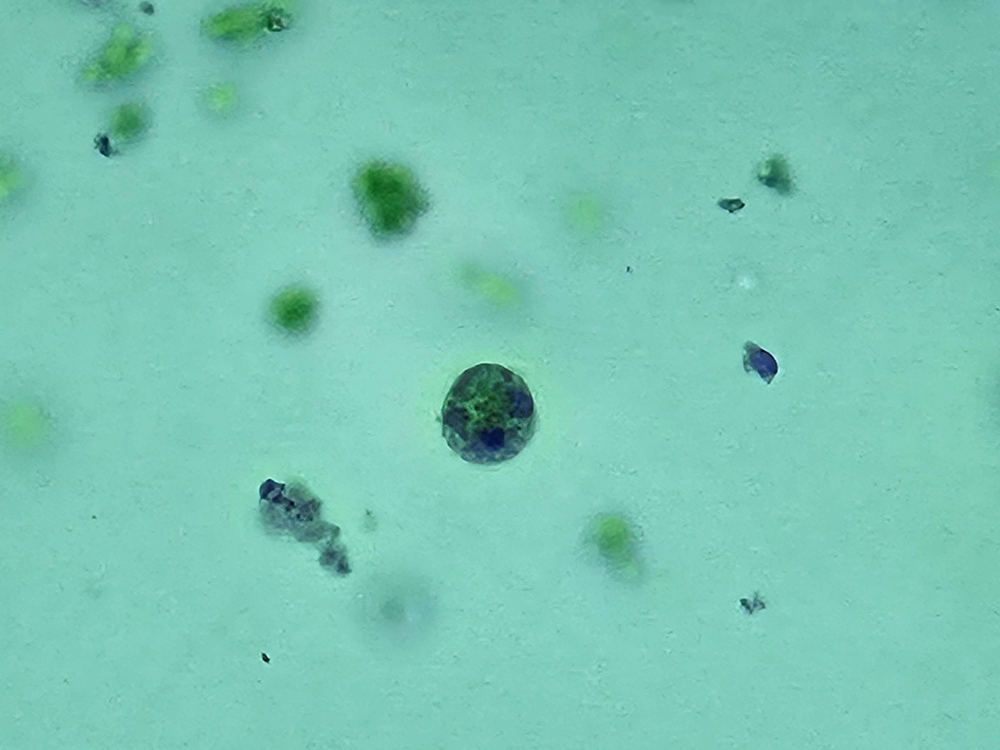 <p><span data-name="microscope" data-type="emoji">🔬</span><span data-name="petri_dish" data-type="emoji">🧫</span><strong><span> </span>Na podstawie zdjęcia preparatu:</strong></p><p></p><ul><li><p><span data-name="book" data-type="emoji">📖</span><span> </span>rozpoznaj gatunek pasożyta;</p></li></ul><p></p><ul><li><p><span data-name="recycle" data-type="emoji">♻</span><span> </span>rozpoznaj wszystkie formy rozwojowe;</p></li></ul><p></p><ul><li><p><span data-name="microbe" data-type="emoji">🦠</span><span> </span>wskaż organelle i cechy charakterystyczne dla danego gatunku;</p></li></ul><p></p><ul><li><p><span data-name="mask" data-type="emoji">😷</span><span> </span>nazwij chorobę, którą pasożyt wywołuje.</p></li></ul><p></p>