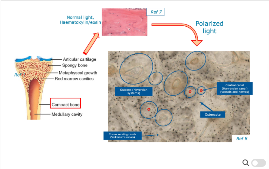 <p>Need to stain using Haemotoxylin Eosin stain - appears pink under normal light conditions - stains a wide variety of cytoplasmic, nuclear and extracellular matrix features. </p><ul><li><p>Then we apply polarised light to the tissue section which enables different structures to be seen slightly differently e.g. haversian canals you acan see osteocytes, volkmann’s canals and haversian systems. </p></li></ul><p></p>