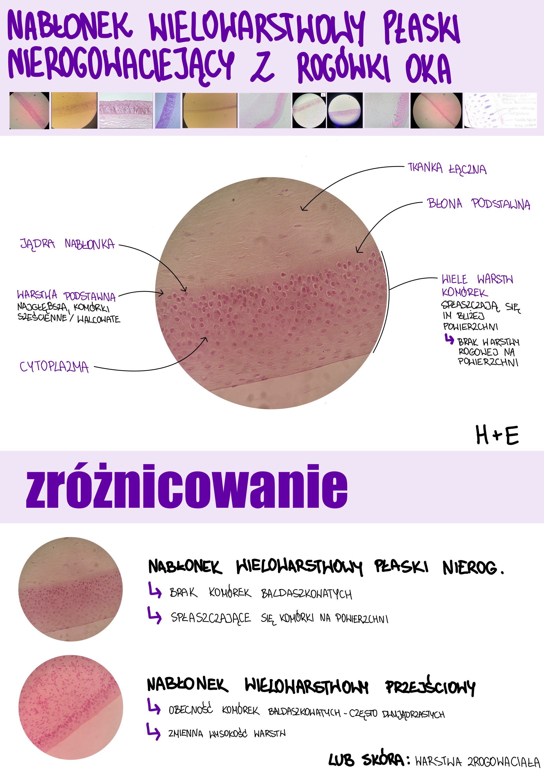 <p>Nabłonek wielowarstwowy płaski nierogowaciejący z rogówki oka</p>