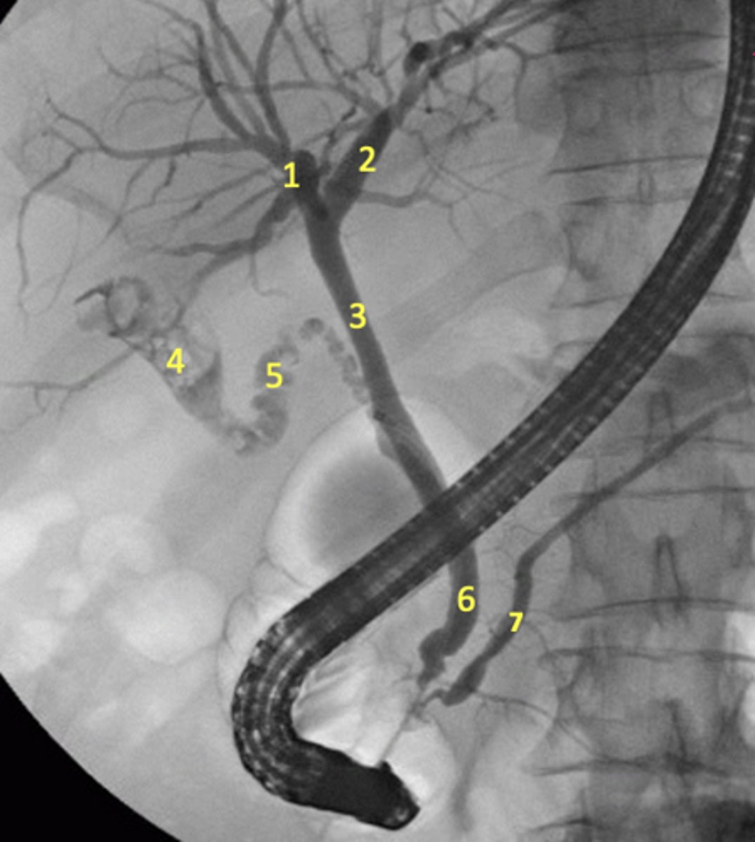 <p>Label the radiograph</p>