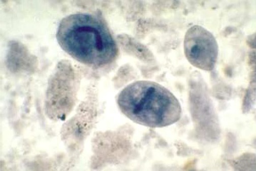 <p>Identify: Protozoa</p>