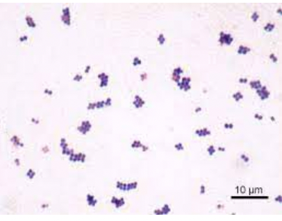 * forms 2-3 mm wide, moist-looking colonies
* opaque, off-white, or sometimes yellow
* gram-positive cocci