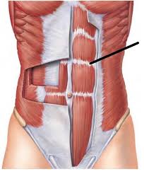 <p>ventral trunk </p>