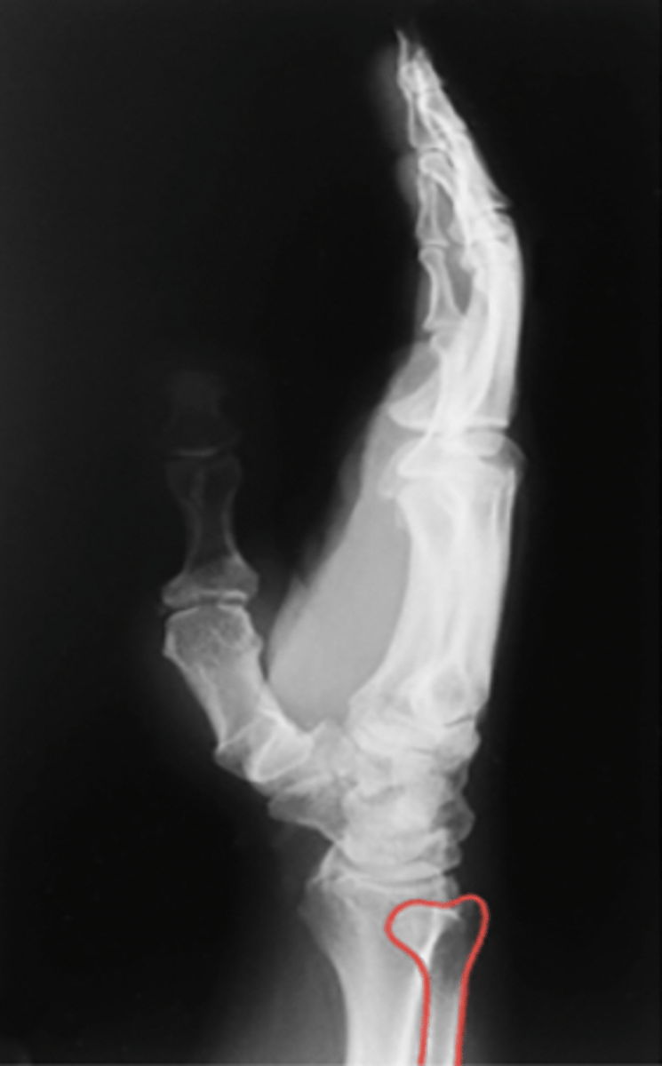 <p>What structure is highlighted?</p>
