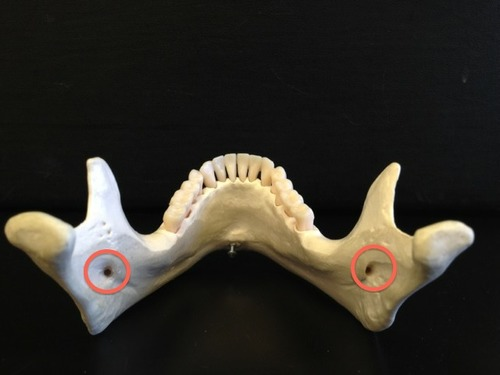 <p>Must open the lower jaw of skull to identify this prominent foramen on the medial aspect of the mandibular ramus. Permits the passage of the nerve involved with tooth sensation and is the site where the dentist injects Novocain to prevent pain while working on the lower teeth</p>