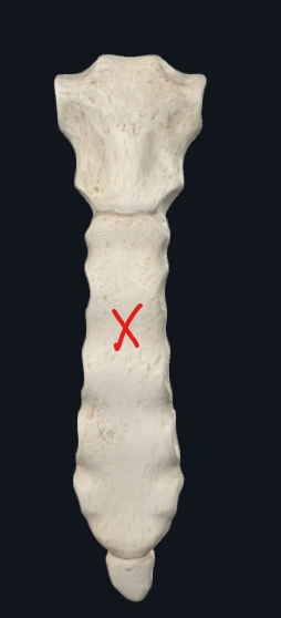 <p>What is this called? (X)</p>