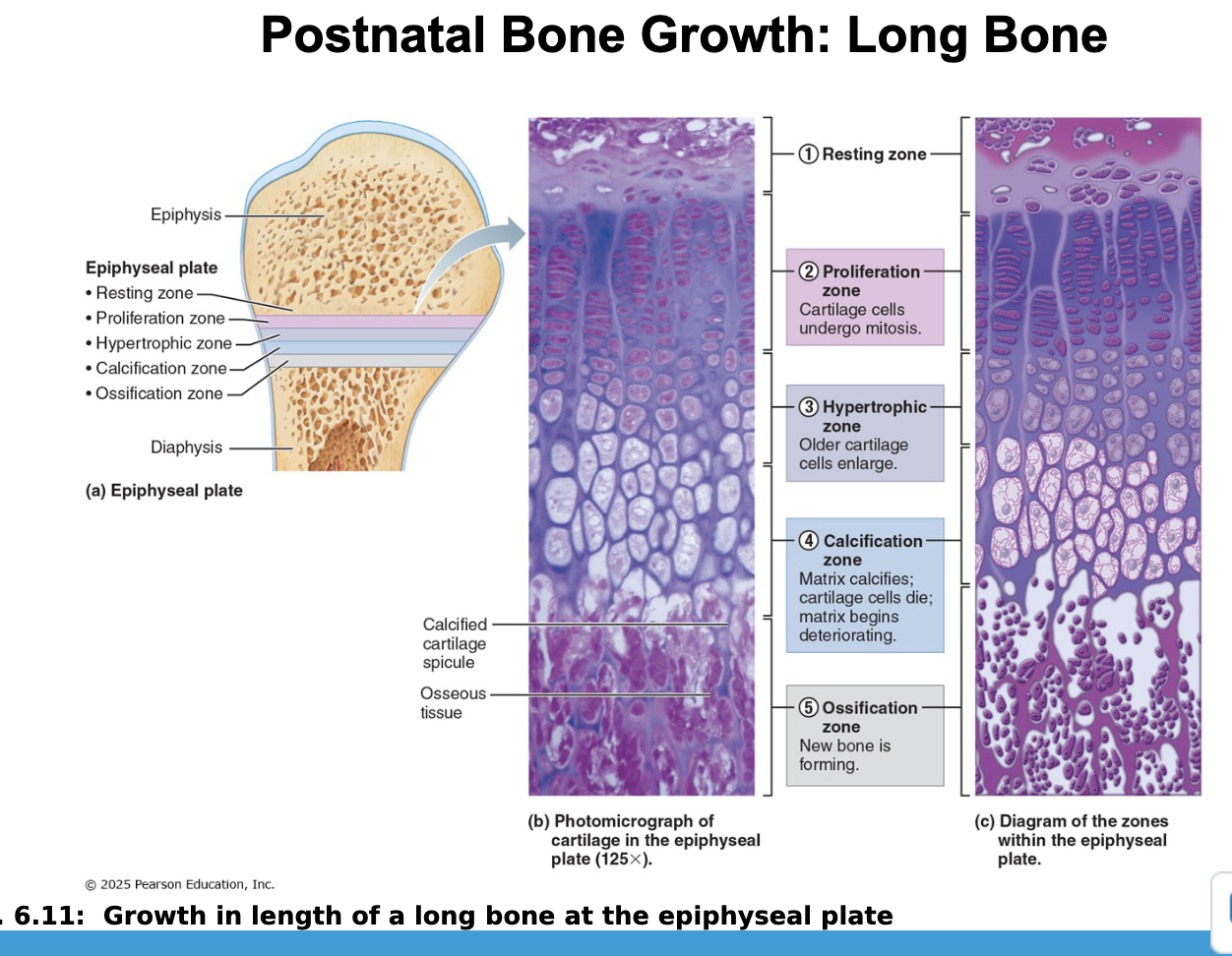 <ul><li><p>During infancy &amp; youth, long bones lengthen entirely by interstitial growth of the epiphyseal plates</p></li><li><p>All bones grow in thickness by appositional growth</p></li><li><p>Most bones stop growing during adolescence or in early adulthood - some facial bones (eg. nose &amp; lower jaw) continue to grow (almost imperceptibly) throughout life</p></li></ul><p></p>