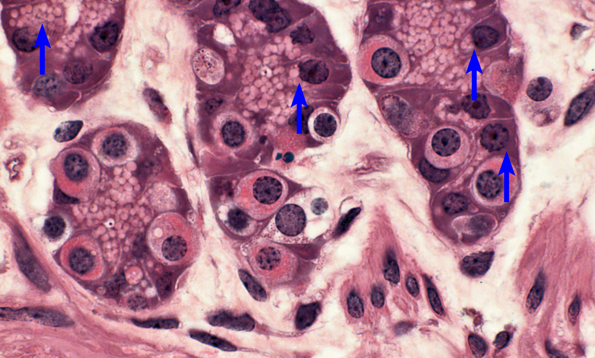 <p>smaller cell with a dark purple nucleus and a light purple cytoplasm in the lower regions of the gastric glands, secrete pepsinogen which is converted to pepsin (breaks down proteins into smaller peptides)</p>