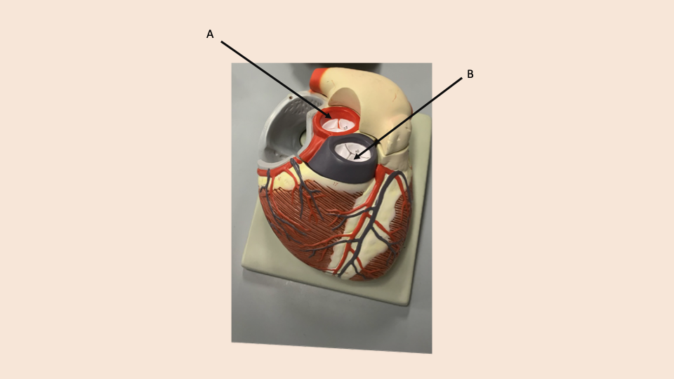 <p>what is A</p>