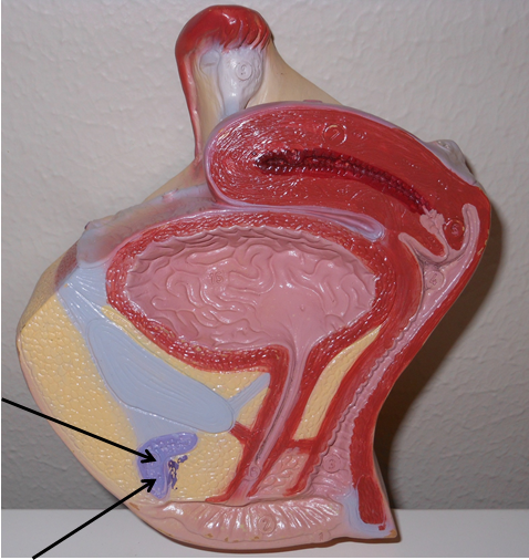 <p>What is the structure indicated in the photo?</p>