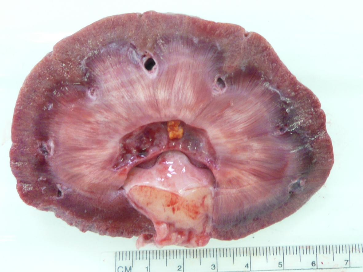 <p>What organ is this? Give a morphological description, morphological diagnosis</p>
