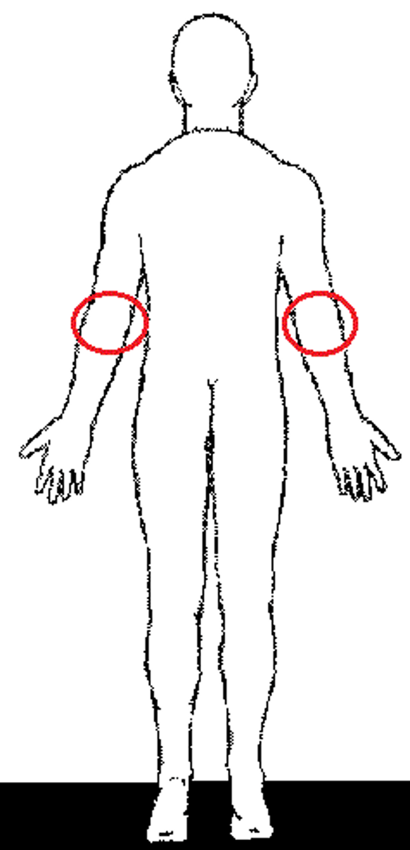 <p>posterior surface of elbow</p>