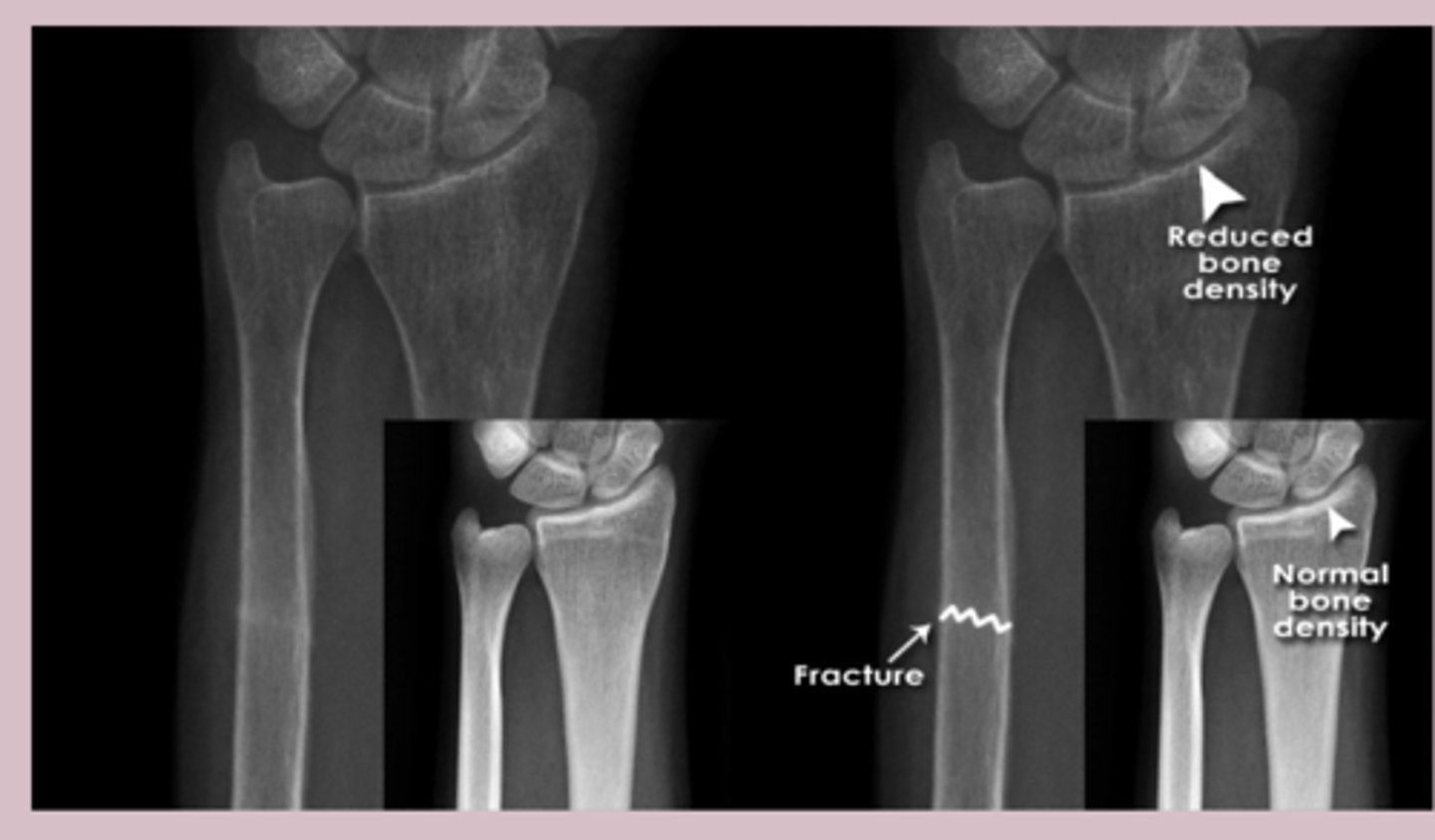 <p>bones</p>
