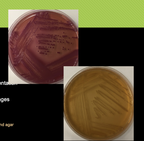 <p>Macconkey agar only allows growth for </p>