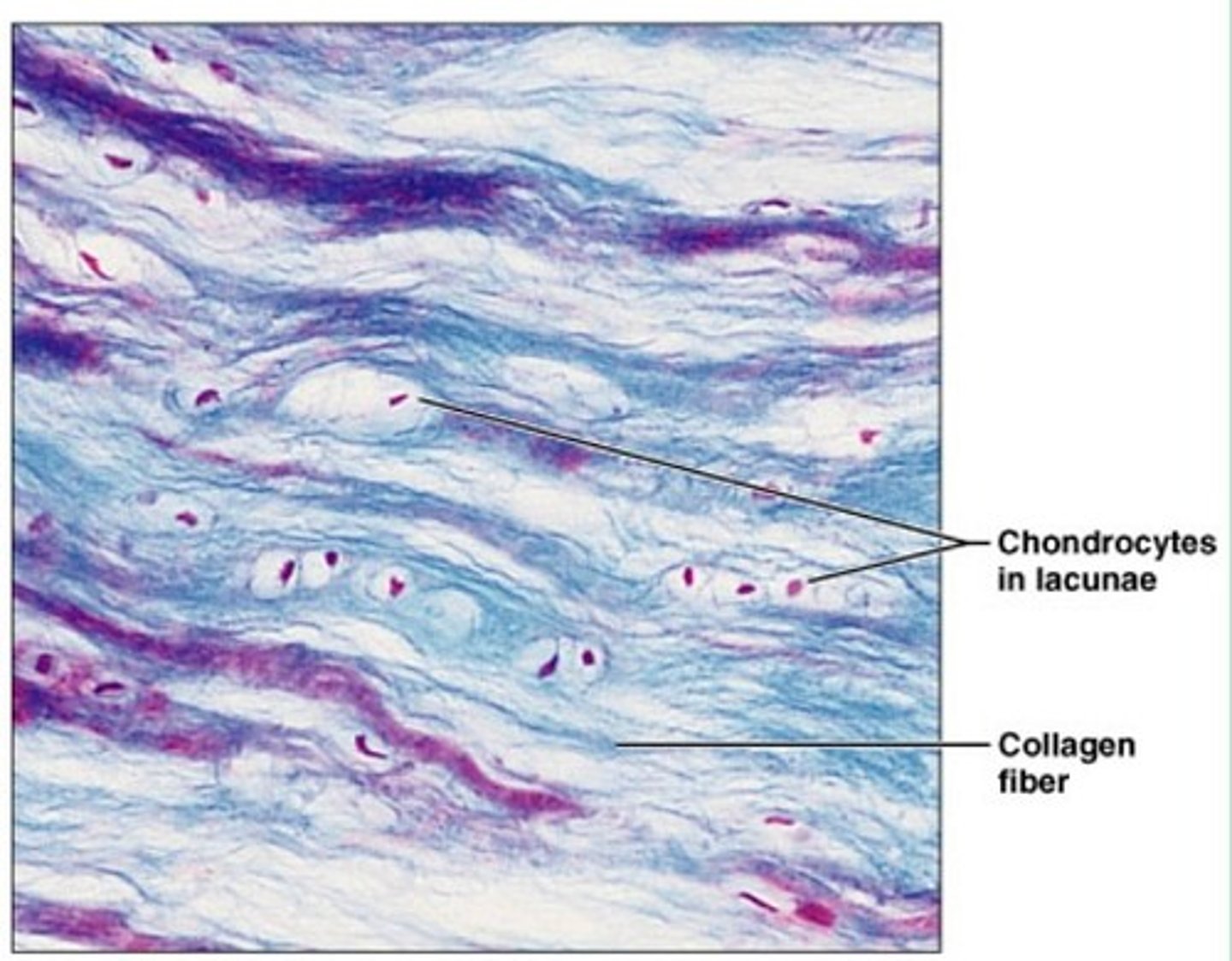 <p>Numerous collagen fibers</p><p>No perichondrium</p><p>Location: symphysis pubis, intervertebral discs, menisci of knees</p><p>Function: Protection at weight-bearing or stressed joints, shock absorption, resistance to compression</p><p>Lucuna: inside is a chondrocyte nucleus</p>