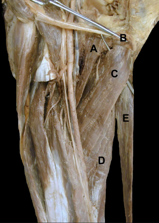<p>Identify the structures on this <strong>Anterior View</strong> of the thigh’s <strong>Adductors</strong></p>