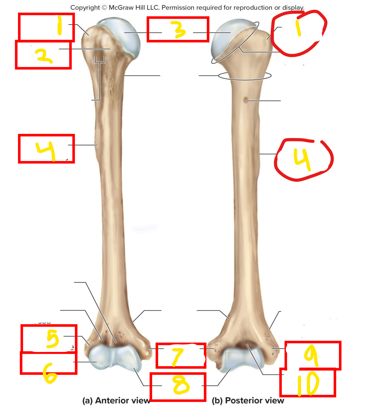 <p>What bone is this</p>