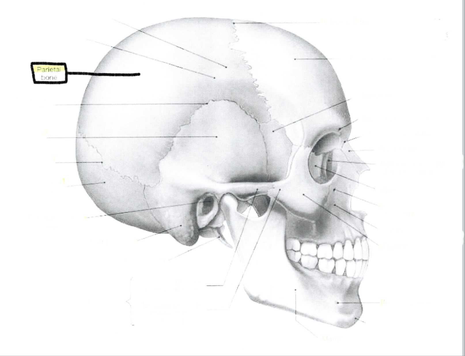<p>Parietal bone</p>