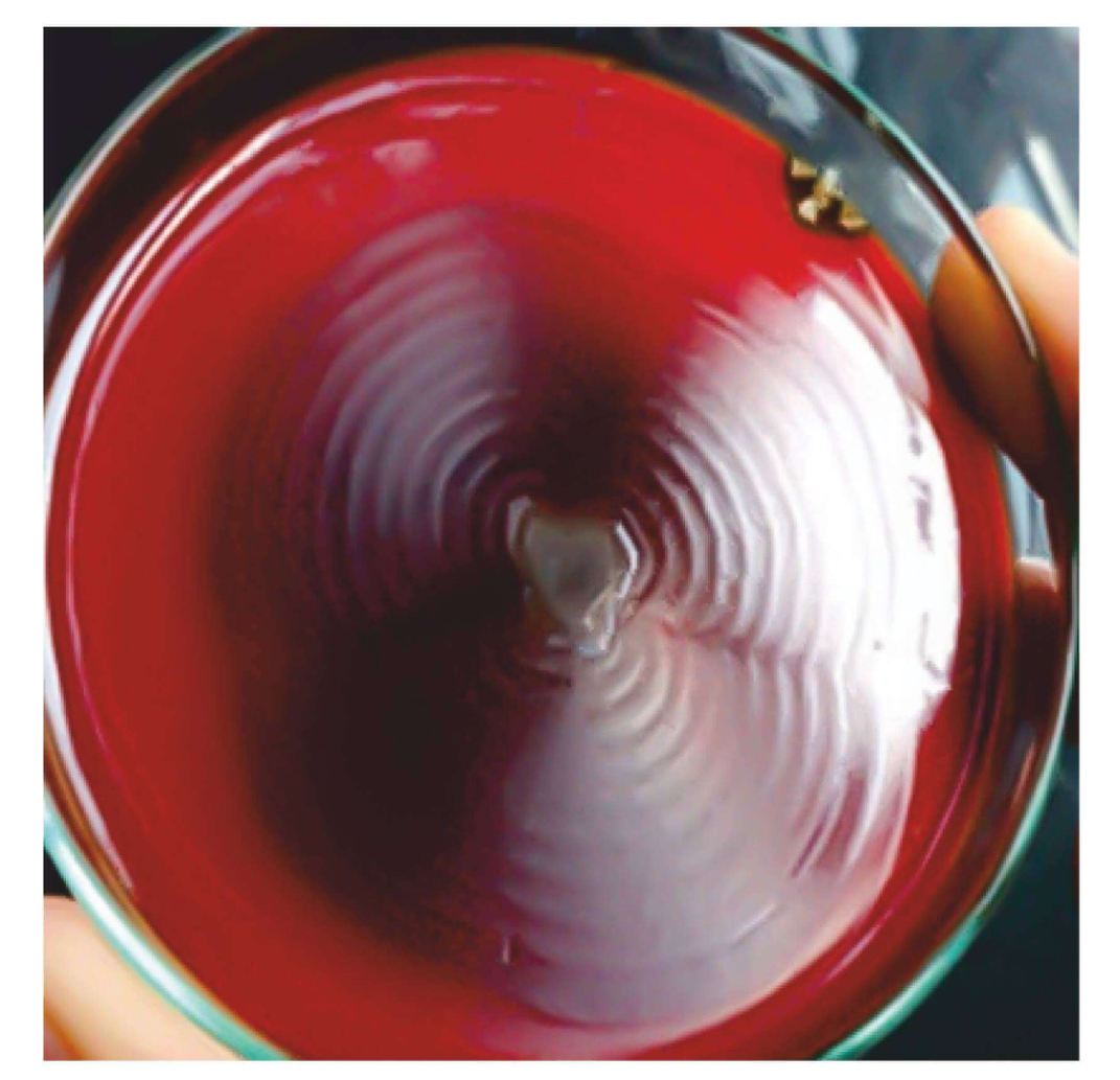 <p>Swarming Growth or Motility</p>