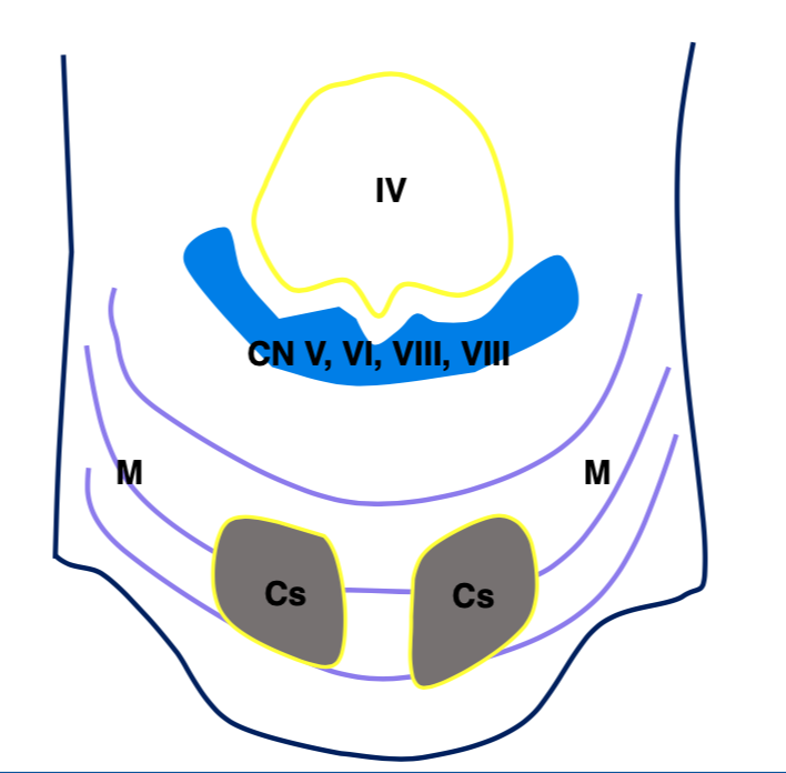 <p>What is structure M?</p>