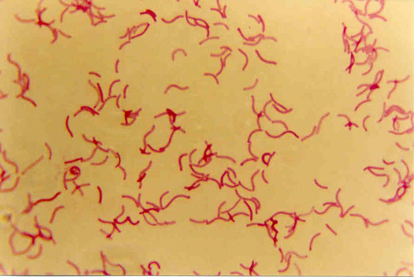 <p>spiral shaped bacteria</p>