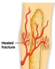 callus works almost like new
