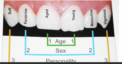 <ol><li><p>Sex: male or female </p></li><li><p>Personality: soft or vigorous</p></li><li><p>Age: old or young, with mamelons (small bumps on teeth) in younger individuals </p></li></ol><p></p>