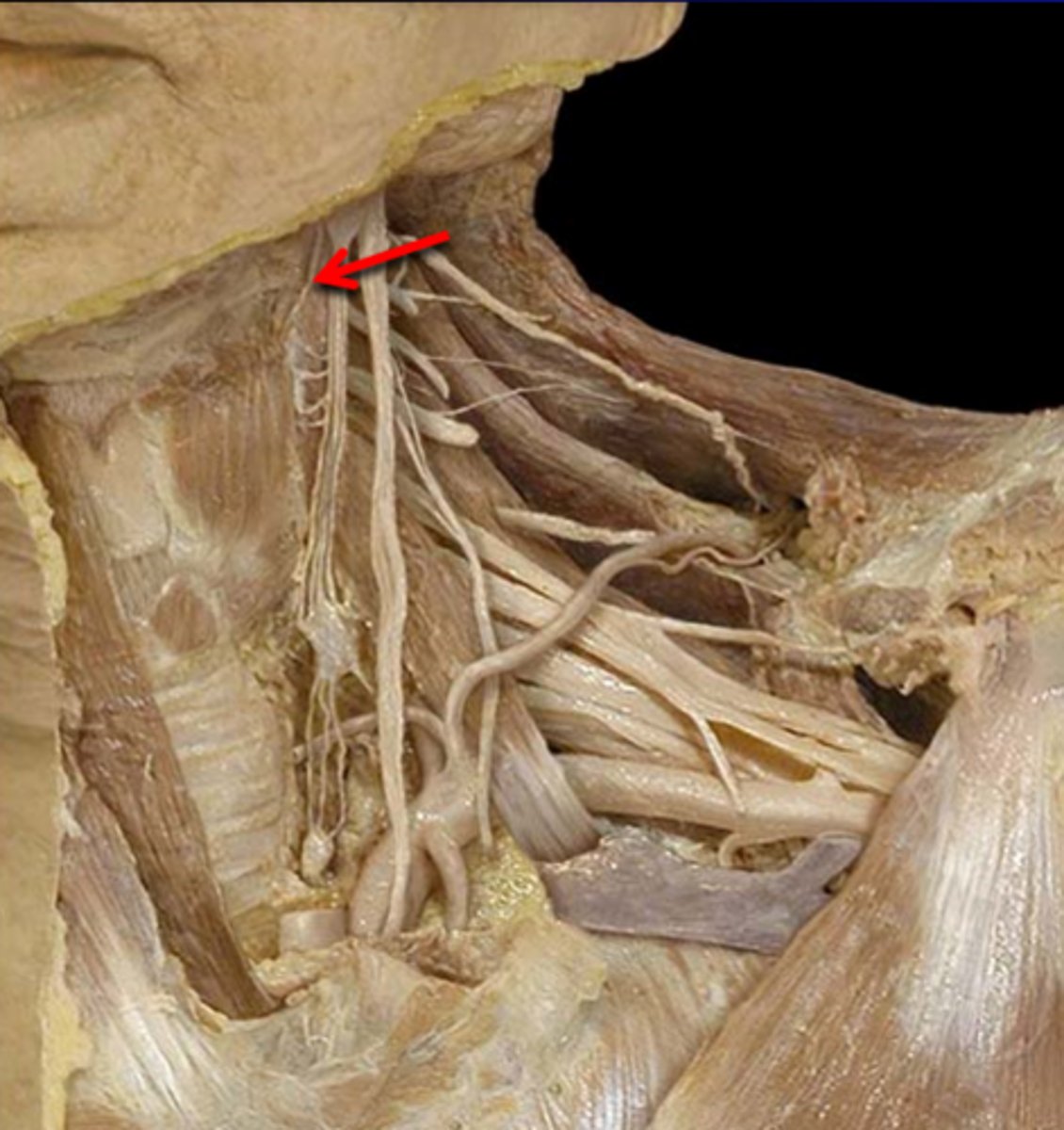 <p>Name the Nerve</p>