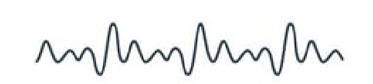 <p><strong>Q:</strong> What does theta frequency represent in EEG?</p>