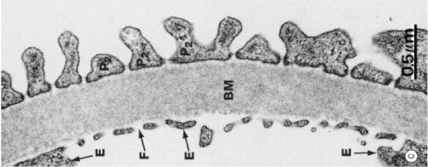 <p>Fenestrated endothelium</p><p>Basement membrane</p><p>Pedicles of podocytes</p>