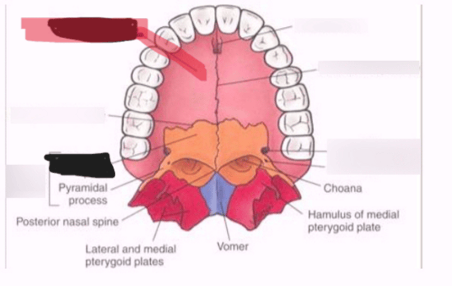 <p>Palatine process of the maxilla</p>