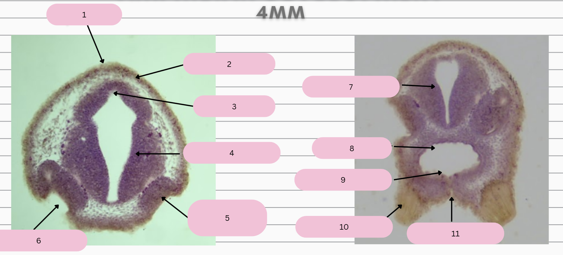 <p>What structure is in 10?</p>