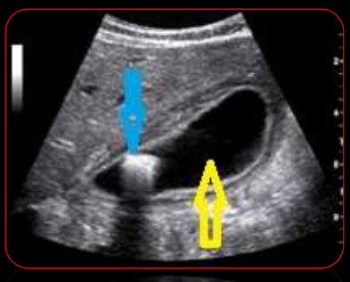 <p>Nomenclatura de la flehca azul y amarilla</p>