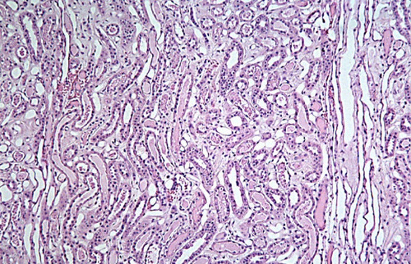 <p>is this the cortex or medulla?</p>