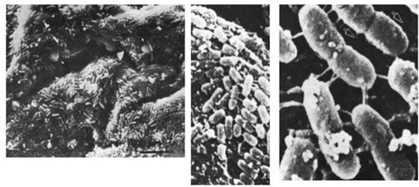 <p>Microbial community in the gastrointestinal tract.</p>