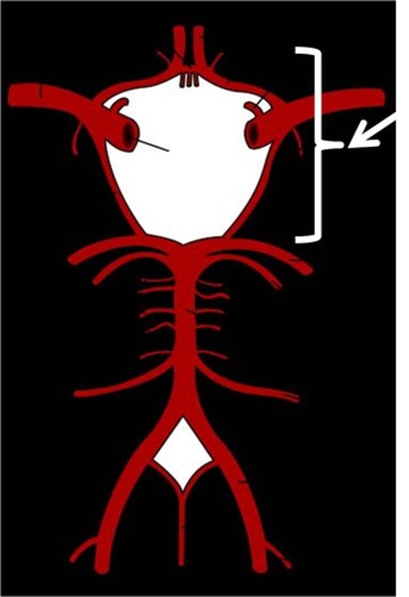 <p>Anastomosis between branches of the ICA and vertebral arteries at base of brain</p>