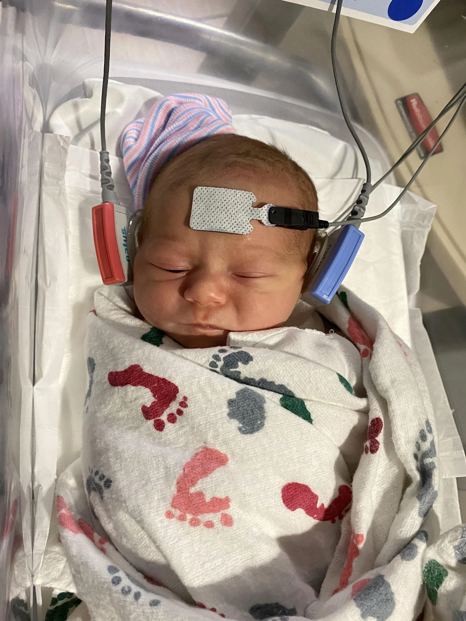 <ol><li><p><span style="color: rgb(83, 133, 238);"><strong>Blood chemistry (not targeted)</strong></span></p></li></ol><ul><li><p><span style="color: rgb(83, 133, 238);"><strong>PKU</strong></span>: Heel Stick</p></li></ul><p></p><ol start="2"><li><p><span style="color: rgb(29, 199, 102);"><strong>Hearing": </strong> ID’s congenital hearing loss</span></p></li></ol><ol start="3"><li><p><span style="color: rgb(203, 67, 238);"><strong>Cardiac</strong></span></p></li></ol><p></p>