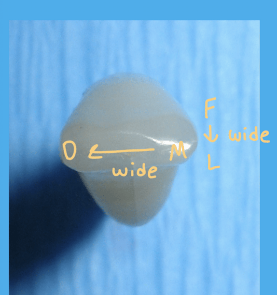 <p>- Crown wider Mesial to Distal (mesiodistally)</p><p>- Incisal ridges ridge straight Facial to Lingual</p>