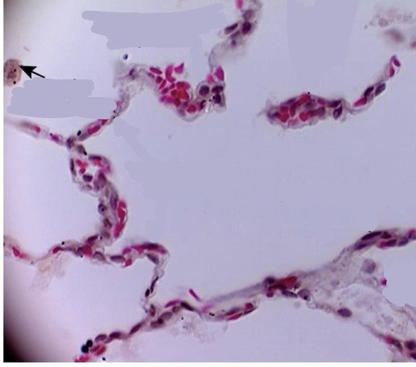 <p>immune, big macrophages</p>