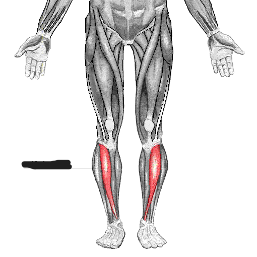 Identify what muscle this is 