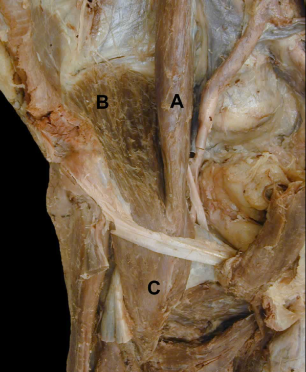 <p>B</p>