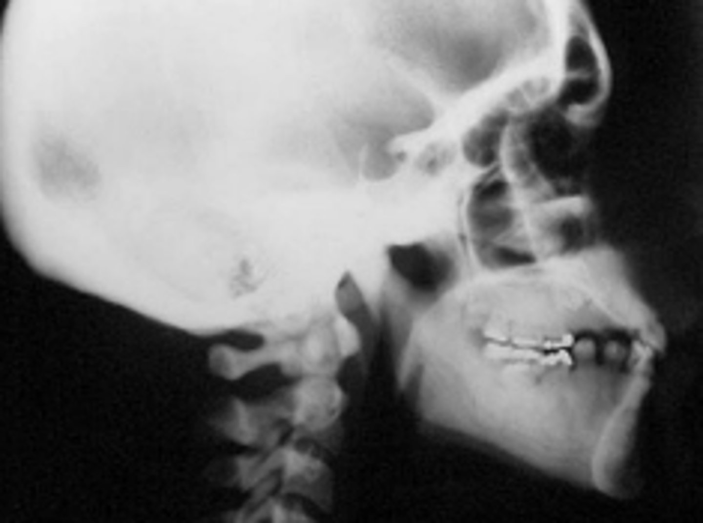 <p>ID the pathology:</p>