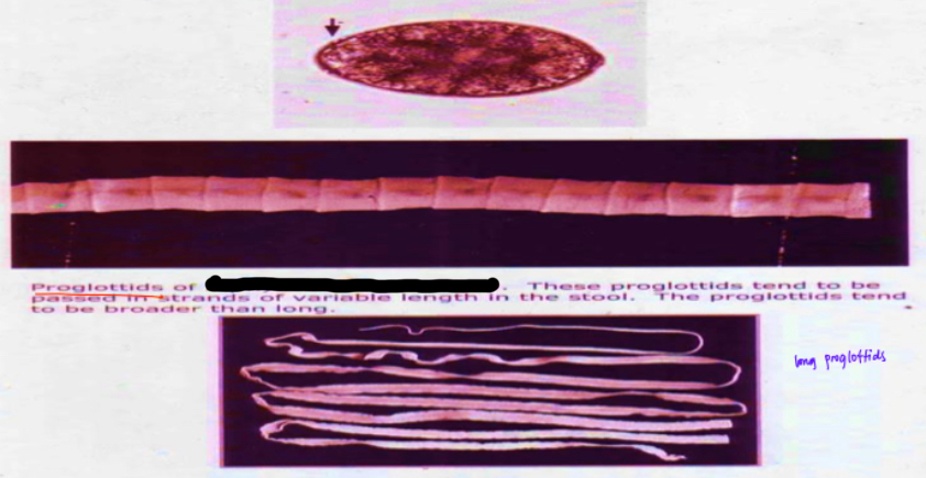 <p>Parasite under microscope </p>