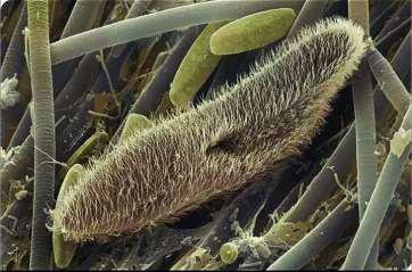 <p>Protozoa that move using hair-like cilia.</p>